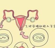 打了达菲林降调针后雌二醇数值5.00算正常吗？