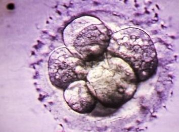 2026年想去定州市做试管婴儿需要准备哪些事？详细收费明细一览